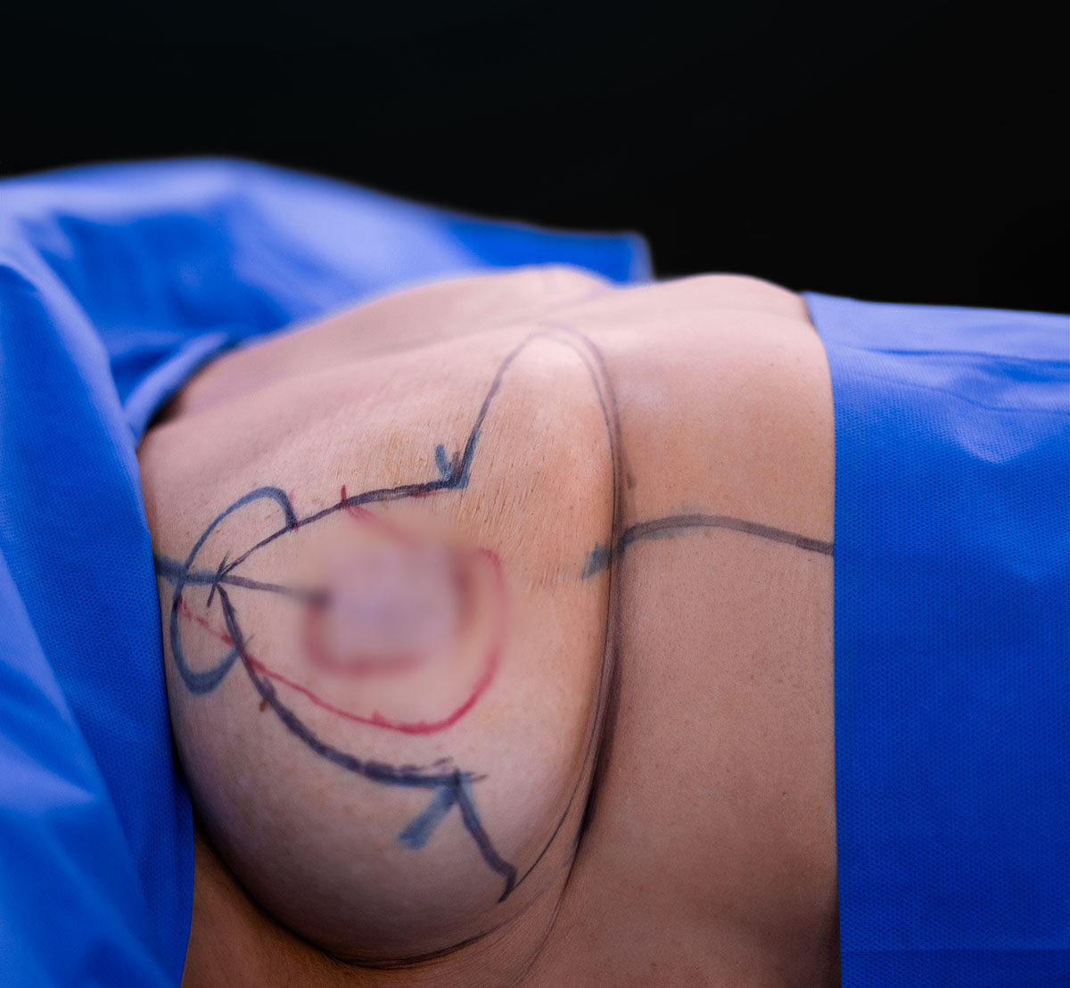 _DSC0375-(1)-Antes-1108